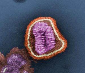 Електронно-микроскопска снимка на грипен вирус. Credit: Kat Masback, flickr (CC BY-SA 2.0)