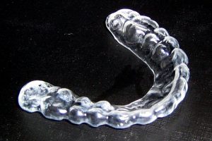 Силиконова шина, която се използва за защита на зъбите при страдащите от бруксизъм.