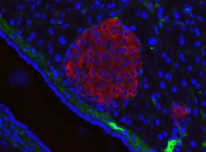 Лангерхансов остров при мишка. Инсулин – червено; ядра на клетките – синьо. Credit: Jakob Suckale (CC BY-SA 3.0)