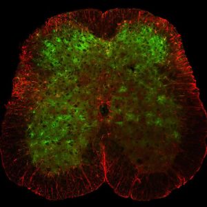 Астроцити (зелено) в гръбначен мозък. Credit: Salk institute