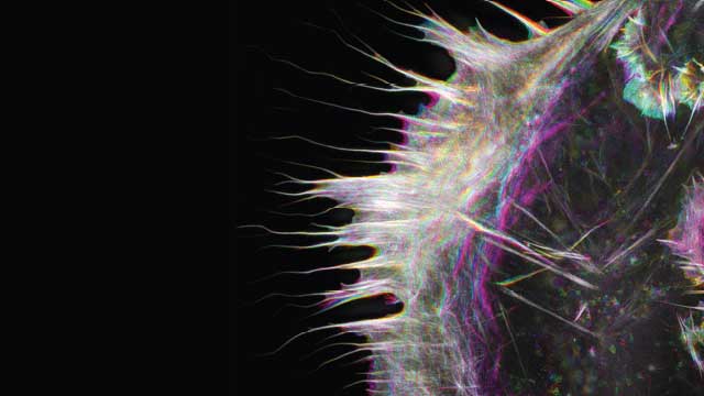 КЛЕТЪЧНО СКЕЛЕ: Това микроскопско изображение със супер-резолюция показва актин в жива свинска бъбречна клетка.