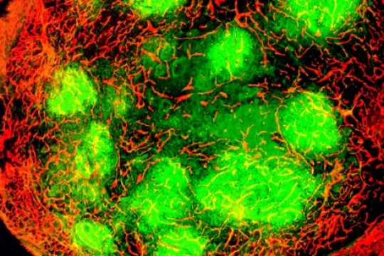 В зелено са оцветени зоните, инфектирани от вируса, а в червено - кръвоносните съдове наоколо. Credit: Image by Donald McDonald Lab