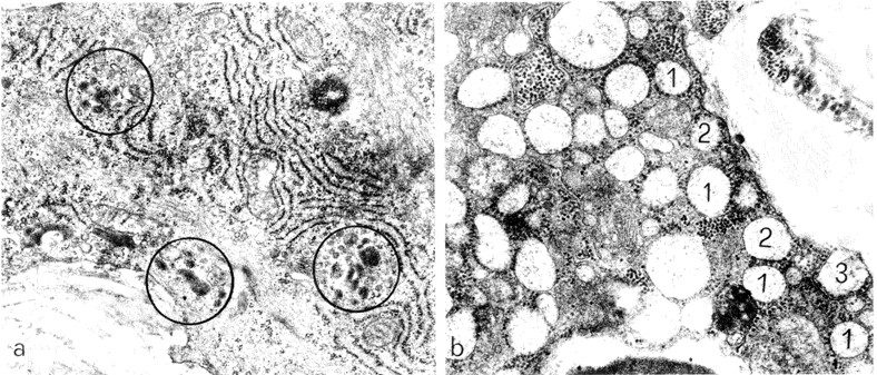 Фигура 6. Електронно-микроскопски микрографии на секреторен фенотип васкуларни гладкомускулни клетки на експериментални животни, третирани със субантимитотични дози колхицин. Клетките отговарят на третирането с (a) натрупване на секреторни гранули (посочени в кръгове) или (b) вакуоларен тип дилатация на цистерните на гранулирания етдоплазматичен ретикулум, някои от които достигат до плазмалемата (1, 2, 3). a, b x 10 000. Източник: (8).