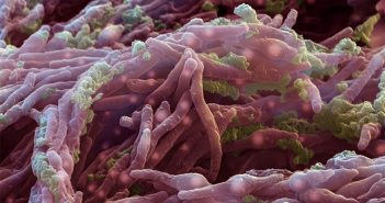Бактериите Mycobacterium tuberculosis са станали твърде устойчиви на медикаменти за туберкулоза.