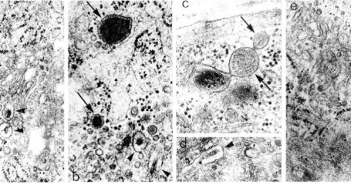 Фигура 4. Електронно-микроскопски микрографии на секреторен фенотип васкуларни гладкомускулни клетки на експериментални животни. a-e. Посочени са секреторни вакуоли със сферична (стрелки) и елонгирана (глави на стрелки) форма. Увеличение x20 000. Източник: (8).